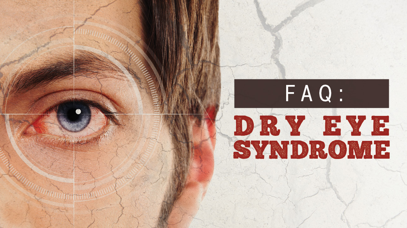 Dry Eye Syndrome Know the Facts Contact our office!